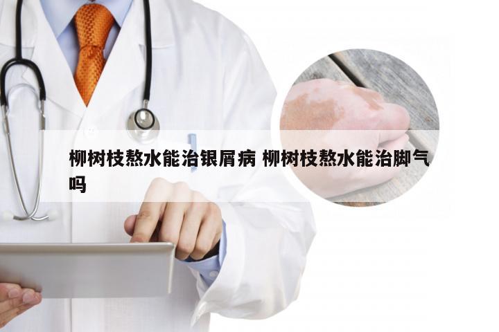 柳树枝熬水能治银屑病 柳树枝熬水能治脚气吗