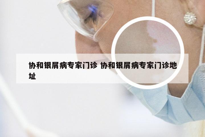协和银屑病专家门诊 协和银屑病专家门诊地址