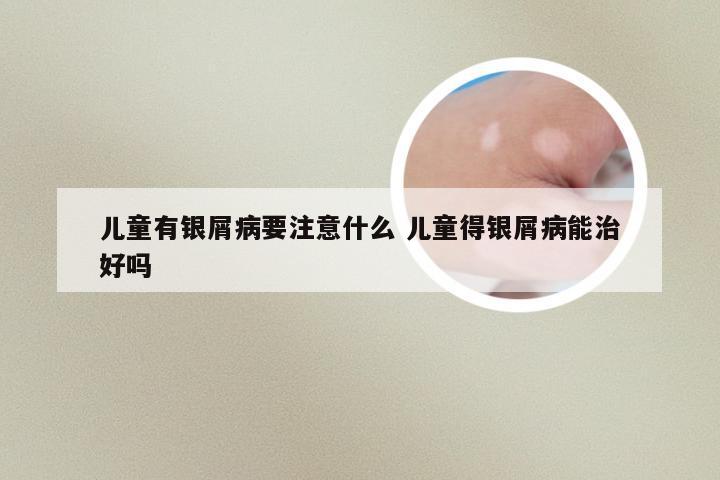 儿童有银屑病要注意什么 儿童得银屑病能治好吗