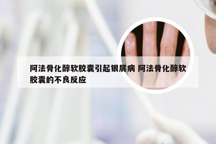 阿法骨化醇软胶囊引起银屑病 阿法骨化醇软胶囊的不良反应