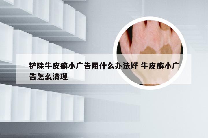 铲除牛皮癣小广告用什么办法好 牛皮癣小广告怎么清理