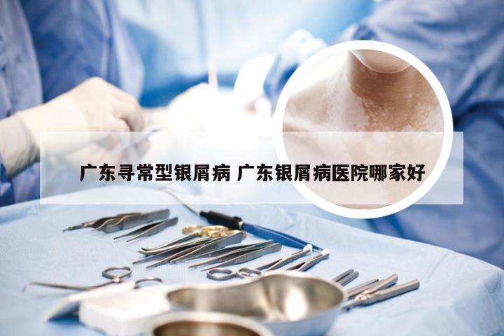 广东寻常型银屑病 广东银屑病医院哪家好