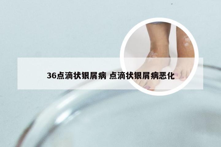 36点滴状银屑病 点滴状银屑病恶化
