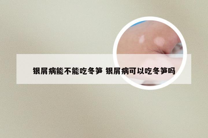 银屑病能不能吃冬笋 银屑病可以吃冬笋吗