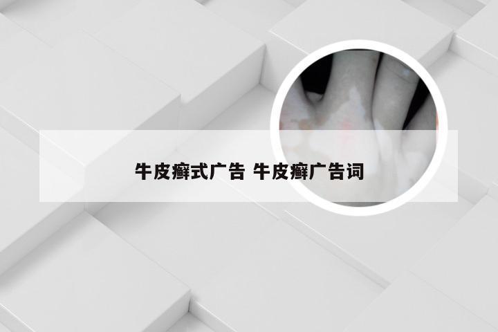 牛皮癣式广告 牛皮癣广告词