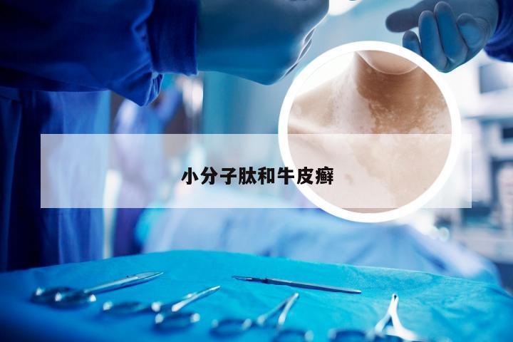 小分子肽和牛皮癣