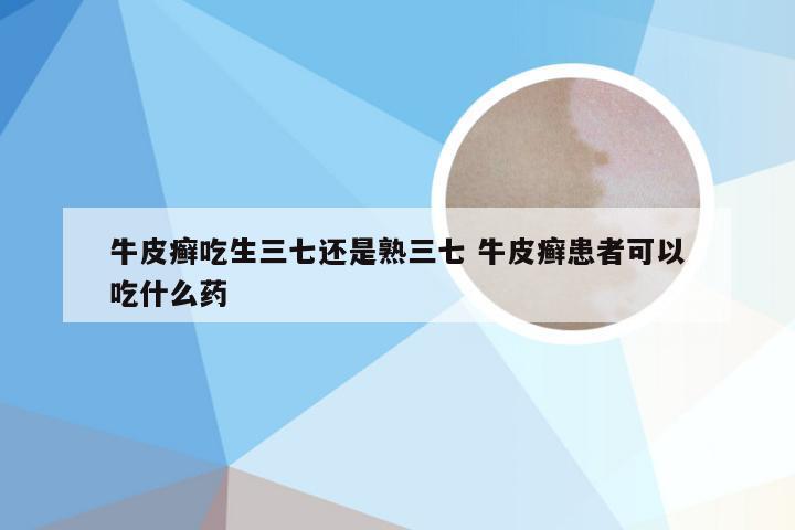牛皮癣吃生三七还是熟三七 牛皮癣患者可以吃什么药