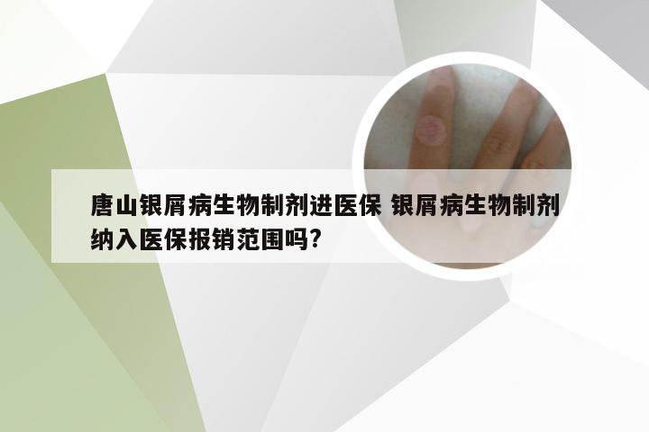 唐山银屑病生物制剂进医保 银屑病生物制剂纳入医保报销范围吗?