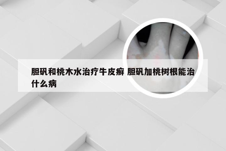 胆矾和桃木水治疗牛皮癣 胆矾加桃树根能治什么病