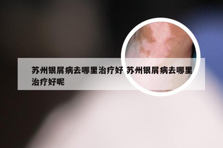 苏州银屑病去哪里治疗好 苏州银屑病去哪里治疗好呢