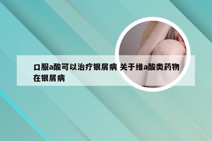 口服a酸可以治疗银屑病 关于维a酸类药物在银屑病