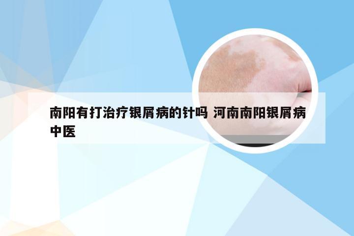 南阳有打治疗银屑病的针吗 河南南阳银屑病中医