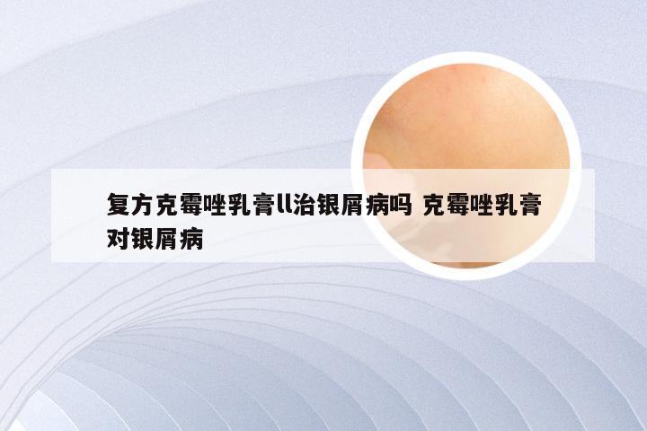 复方克霉唑乳膏ll治银屑病吗 克霉唑乳膏对银屑病
