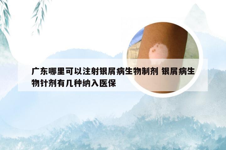 广东哪里可以注射银屑病生物制剂 银屑病生物针剂有几种纳入医保