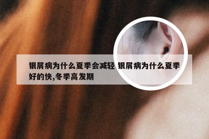 银屑病为什么夏季会减轻 银屑病为什么夏季好的快,冬季高发期