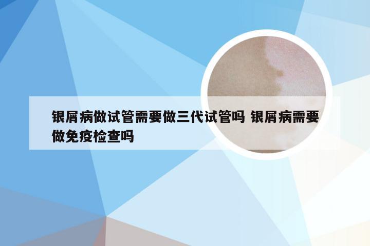 银屑病做试管需要做三代试管吗 银屑病需要做免疫检查吗