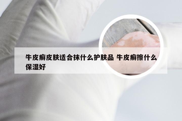 牛皮癣皮肤适合抹什么护肤品 牛皮癣擦什么保湿好