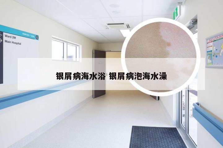 银屑病海水浴 银屑病泡海水澡
