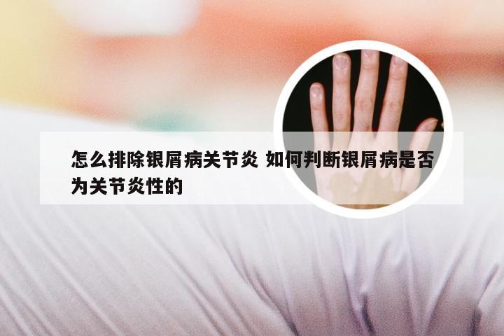 怎么排除银屑病关节炎 如何判断银屑病是否为关节炎性的