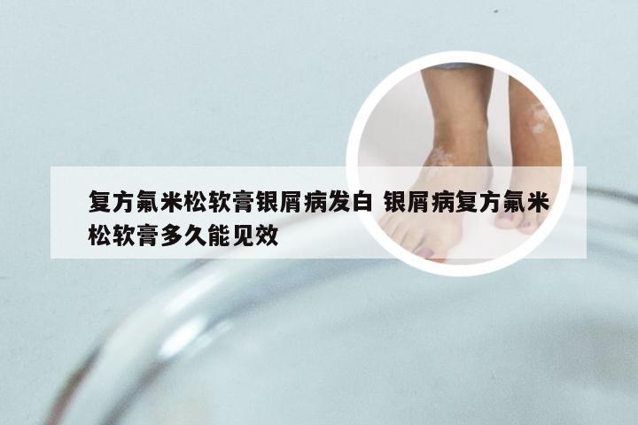 复方氟米松软膏银屑病发白 银屑病复方氟米松软膏多久能见效