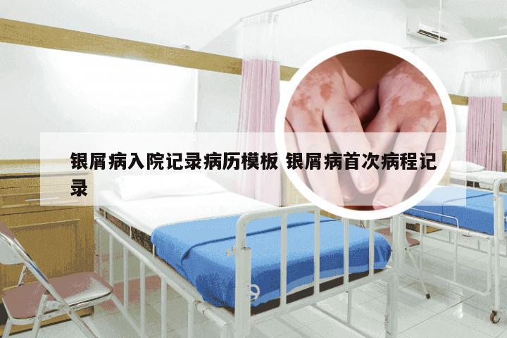 银屑病入院记录病历模板 银屑病首次病程记录