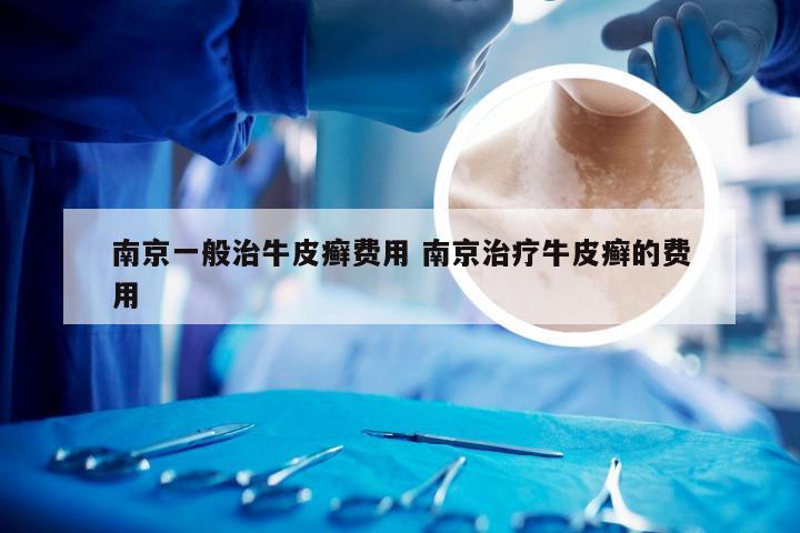 南京一般治牛皮癣费用 南京治疗牛皮癣的费用