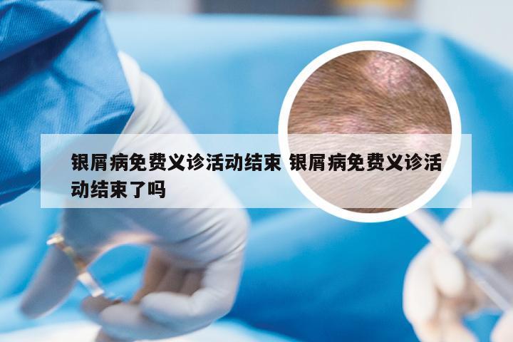 银屑病免费义诊活动结束 银屑病免费义诊活动结束了吗