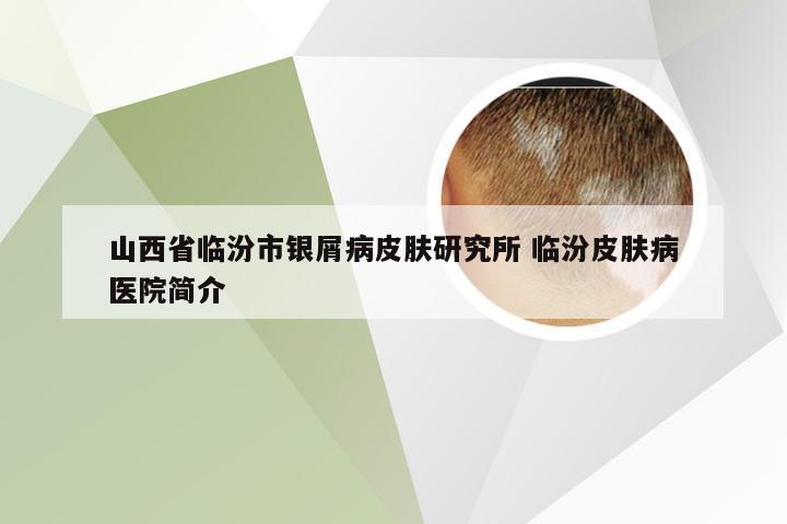 山西省临汾市银屑病皮肤研究所 临汾皮肤病医院简介
