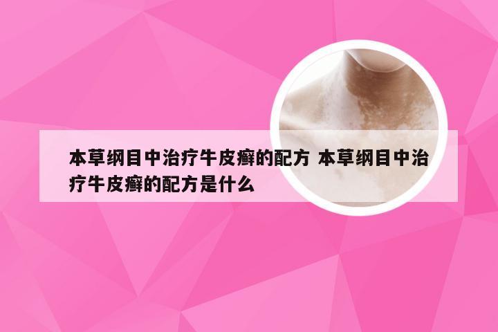 本草纲目中治疗牛皮癣的配方 本草纲目中治疗牛皮癣的配方是什么