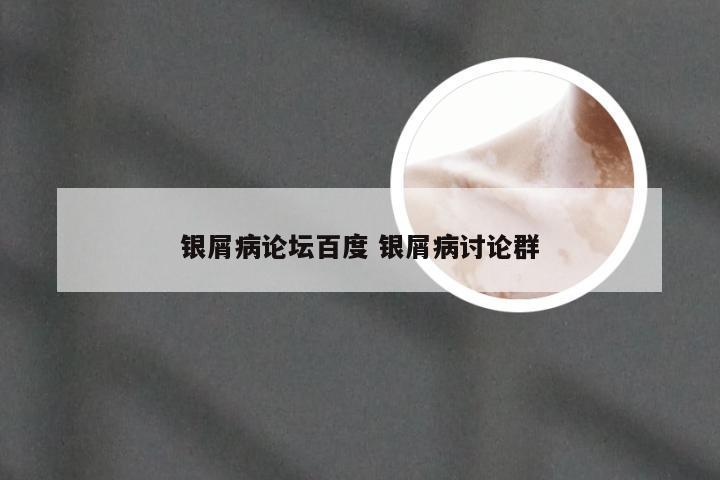 银屑病论坛百度 银屑病讨论群