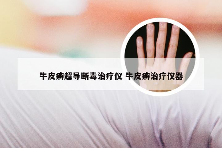牛皮癣超导断毒治疗仪 牛皮癣治疗仪器