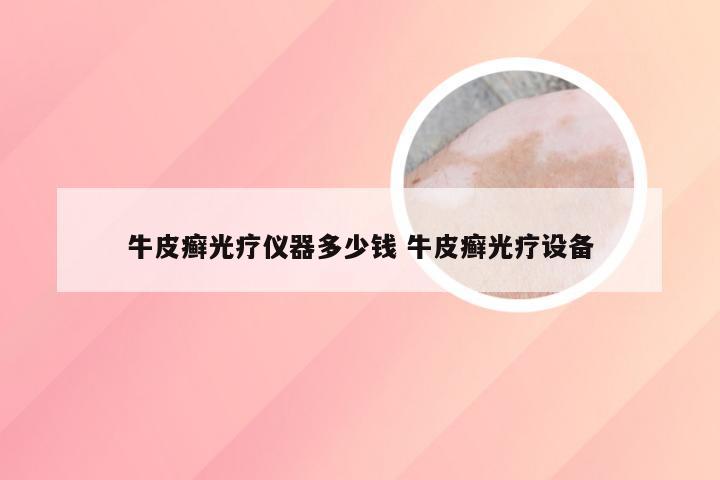 牛皮癣光疗仪器多少钱 牛皮癣光疗设备