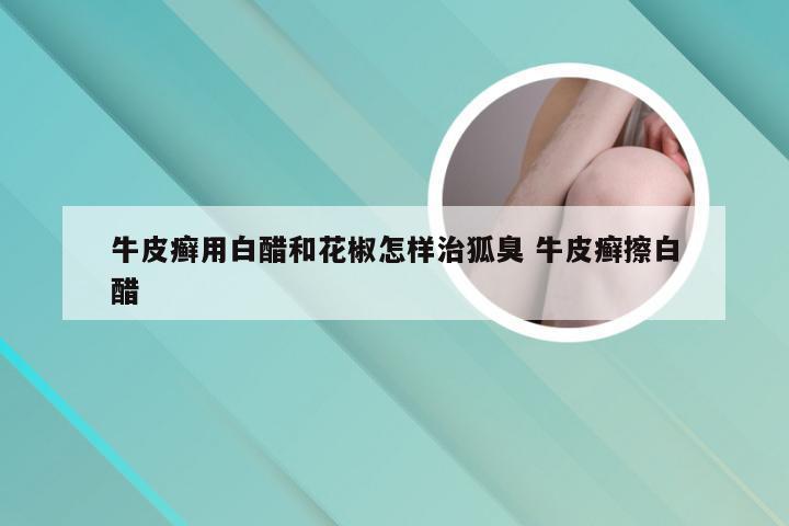 牛皮癣用白醋和花椒怎样治狐臭 牛皮癣擦白醋