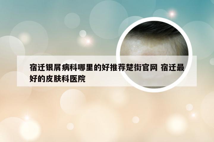 宿迁银屑病科哪里的好推荐楚街官网 宿迁最好的皮肤科医院