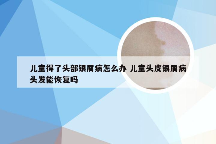 儿童得了头部银屑病怎么办 儿童头皮银屑病头发能恢复吗