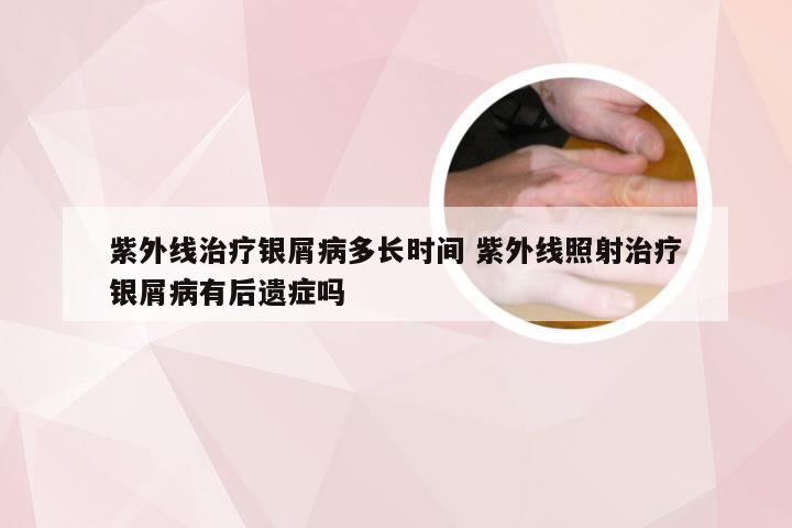 紫外线治疗银屑病多长时间 紫外线照射治疗银屑病有后遗症吗