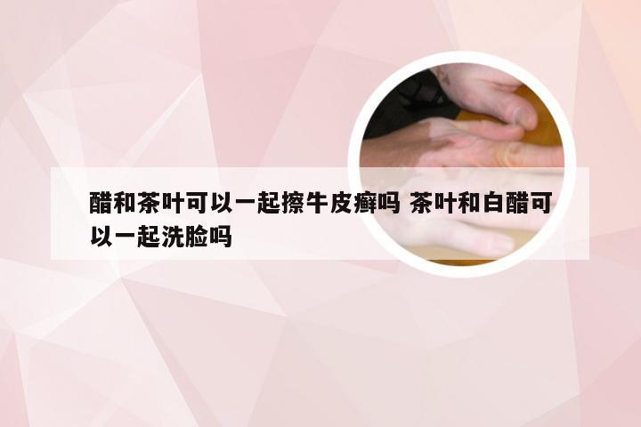 醋和茶叶可以一起擦牛皮癣吗 茶叶和白醋可以一起洗脸吗