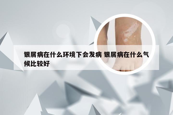 银屑病在什么环境下会发病 银屑病在什么气候比较好