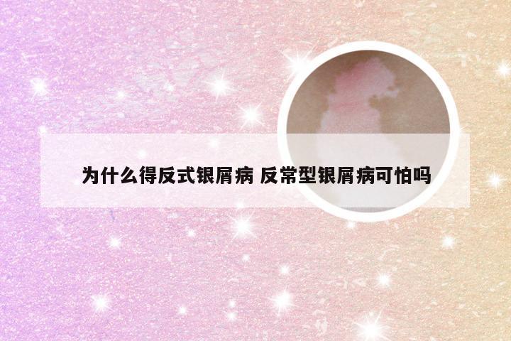 为什么得反式银屑病 反常型银屑病可怕吗