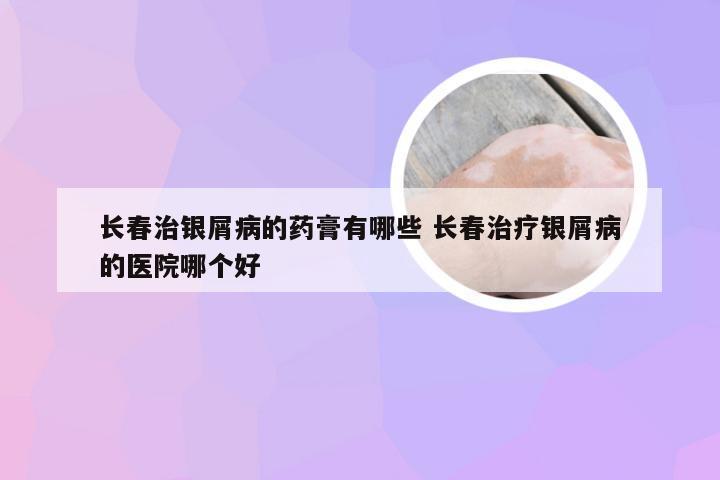 长春治银屑病的药膏有哪些 长春治疗银屑病的医院哪个好