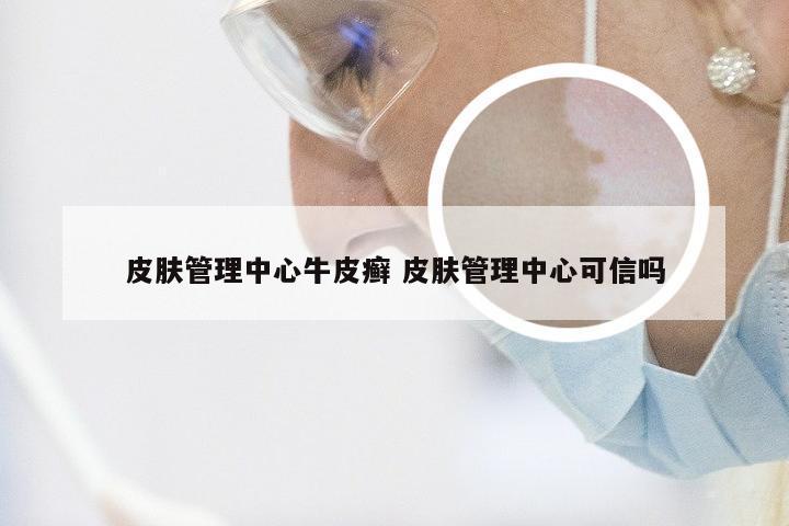 皮肤管理中心牛皮癣 皮肤管理中心可信吗