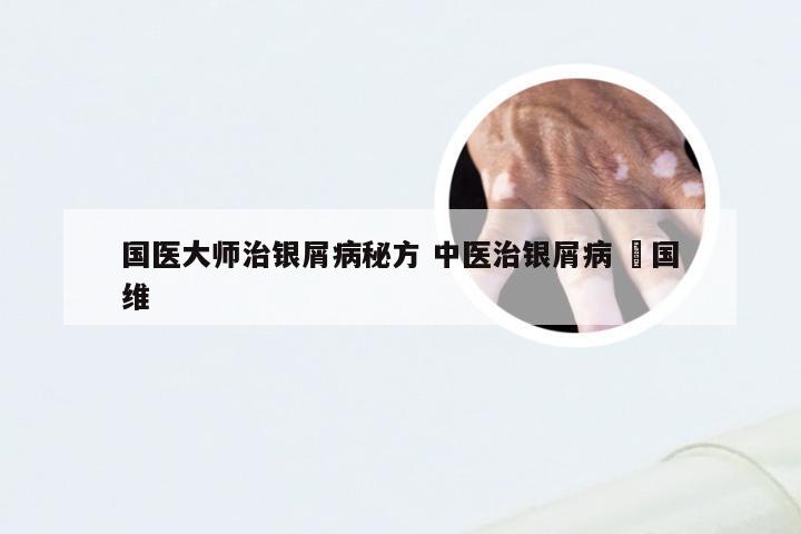 国医大师治银屑病秘方 中医治银屑病 禤国维