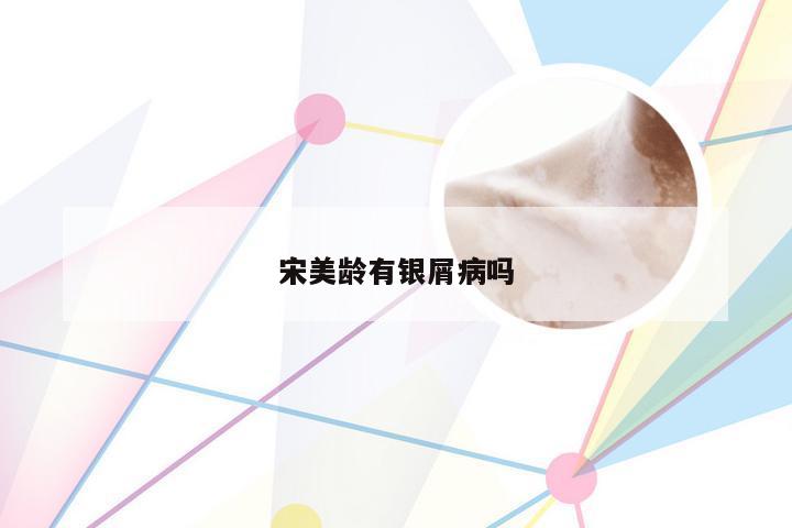 宋美龄有银屑病吗