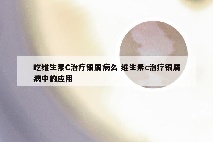 吃维生素C治疗银屑病么 维生素c治疗银屑病中的应用