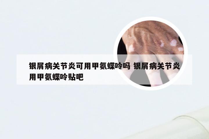 银屑病关节炎可用甲氨蝶呤吗 银屑病关节炎用甲氨蝶呤贴吧