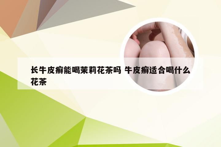 长牛皮癣能喝茉莉花茶吗 牛皮癣适合喝什么花茶