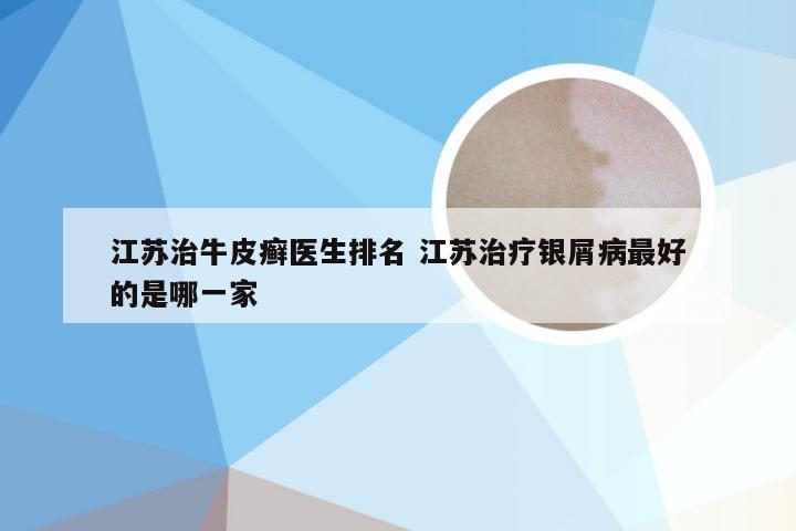 江苏治牛皮癣医生排名 江苏治疗银屑病最好的是哪一家