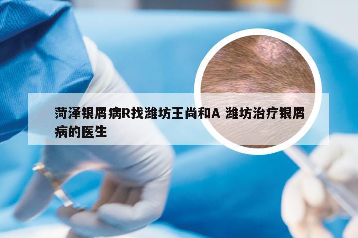 菏泽银屑病R找潍坊王尚和A 潍坊治疗银屑病的医生