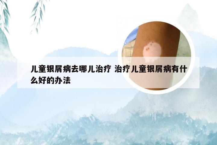 儿童银屑病去哪儿治疗 治疗儿童银屑病有什么好的办法