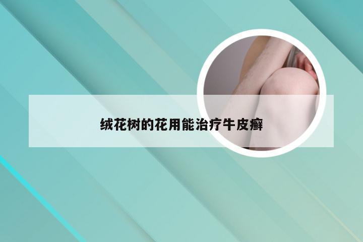 绒花树的花用能治疗牛皮癣
